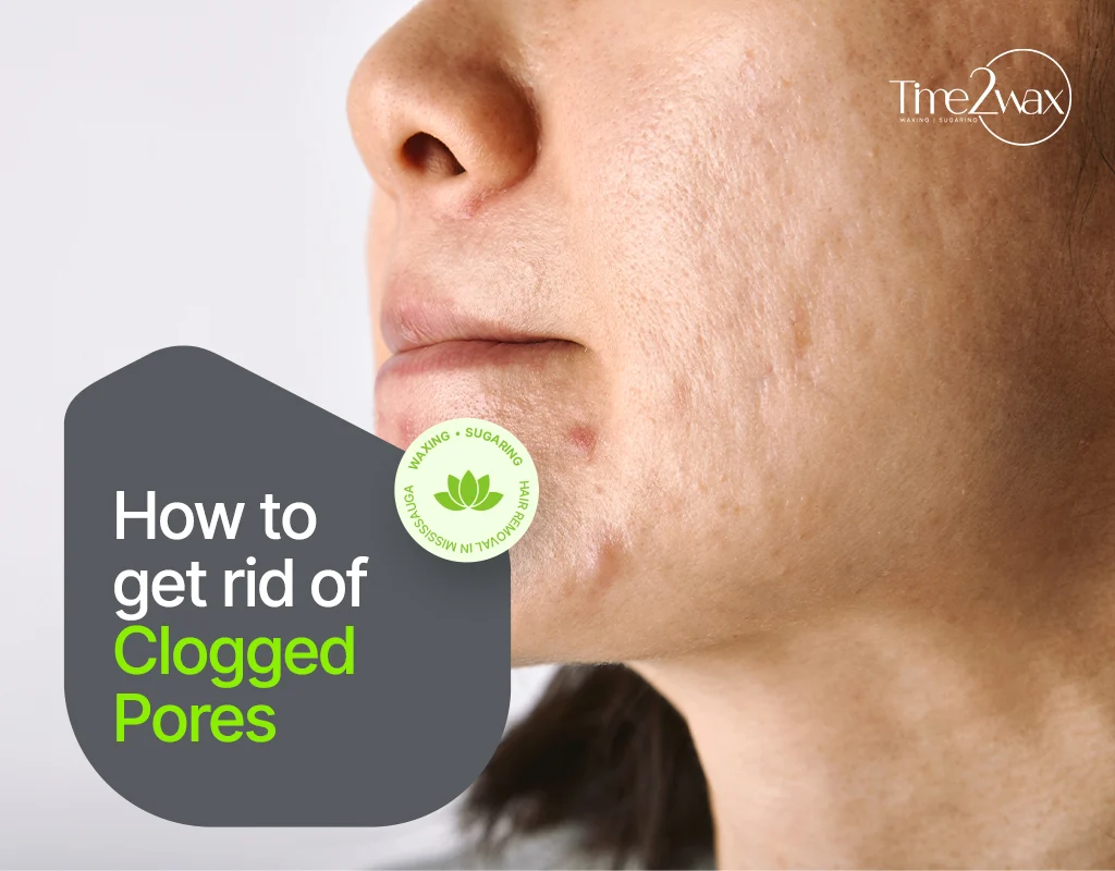 How to Get Rid of Clogged Pores